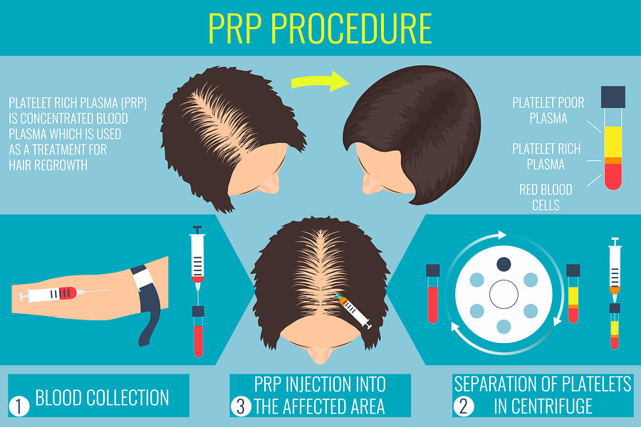 PRP Hair Restoration - Cosmetic & Laser Center